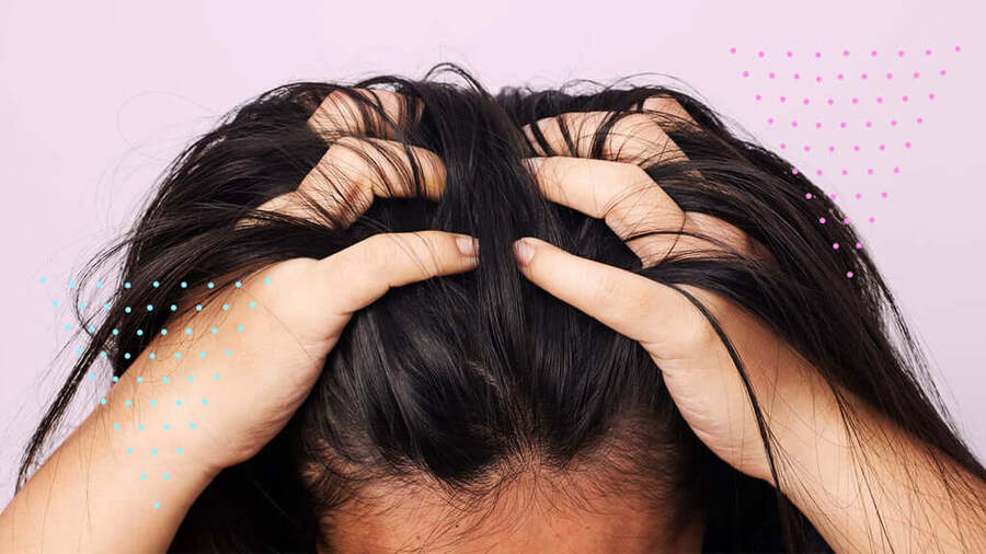 Gàu có thể ảnh hưởng đến tóc và da đầu theo nhiều cách