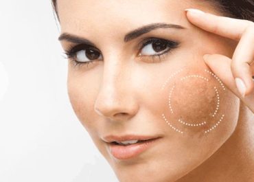 Xu hướng bảo vệ làn da khỏi những tác nhân gây hại từ môi trường - gia công mỹ phẩm chống ô nhiễm