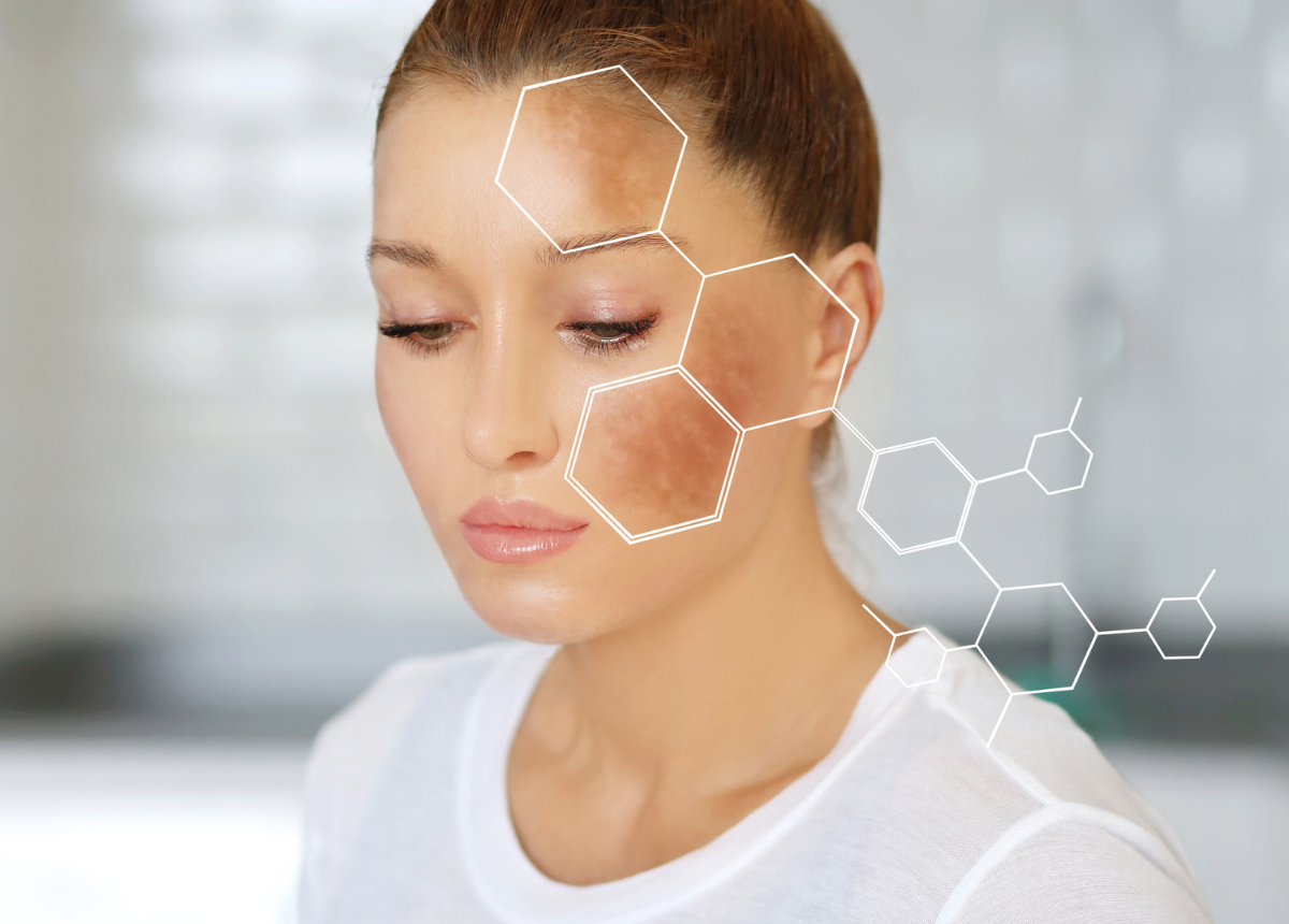 Cơ chế tăng sắc tố melanin trong da