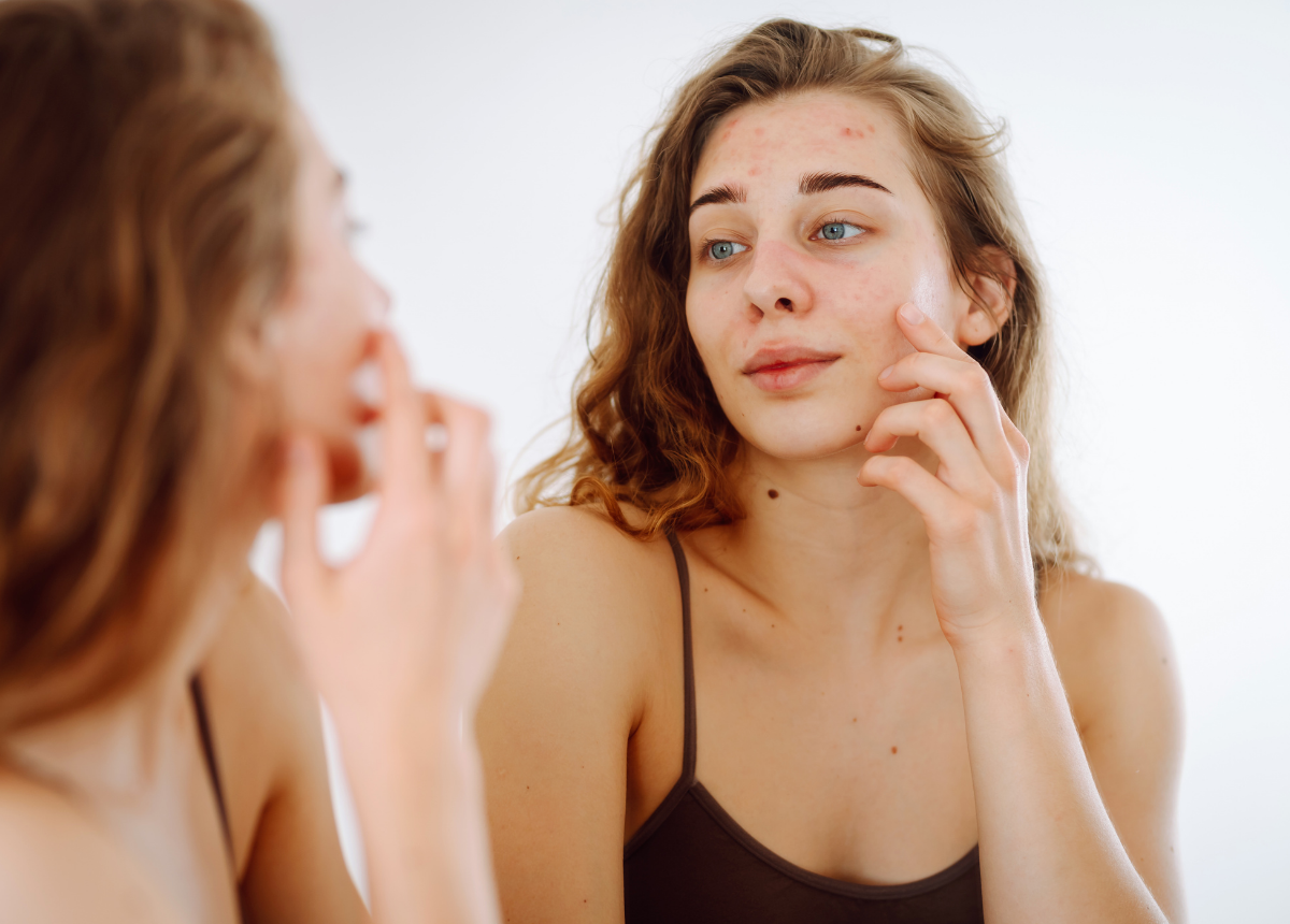Quan niệm đúng về “da không lỗ chân lông” trong skincare hiện đại