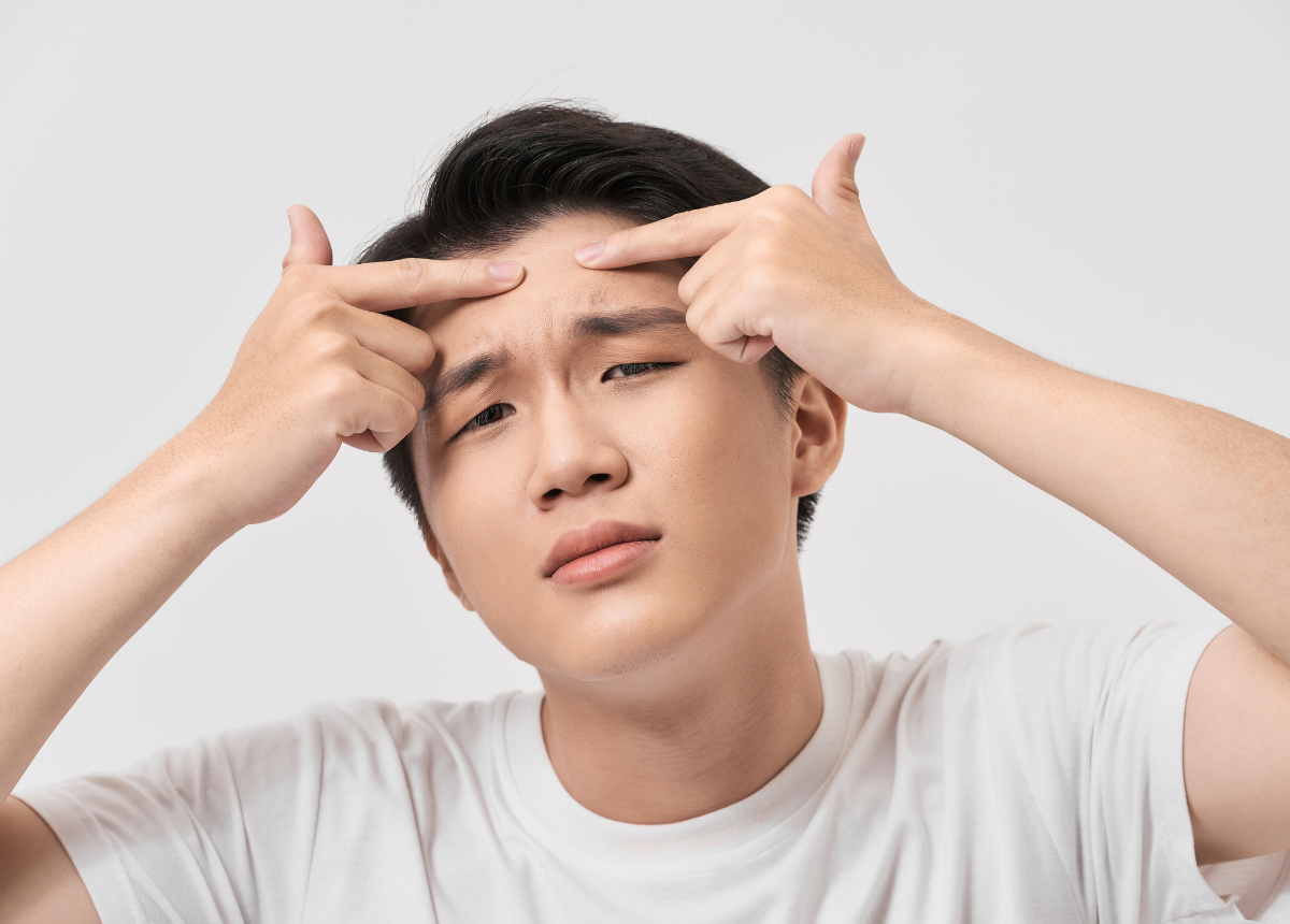Giải mã các vấn đề da phổ biến ở nam giới