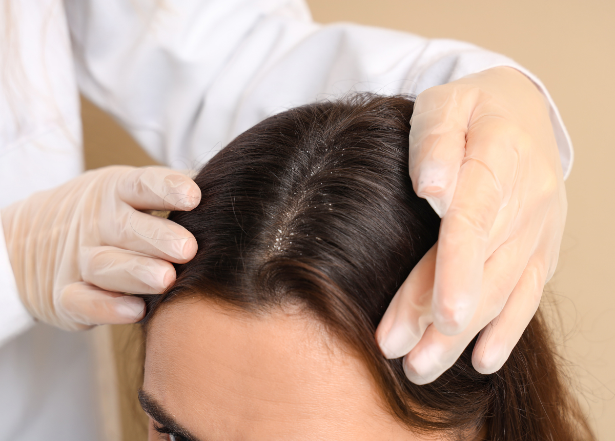 Tẩy tế bào chết da đầu (Scalp Scrub) Mảnh ghép chuyên sâu nâng cấp chu trình chăm sóc tóc