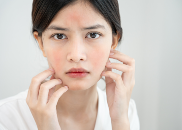 BÍ QUYẾT CHĂM SÓC DA NHẠY CẢM: HƯỚNG DẪN LỰA CHỌN SẢN PHẨM ĐẾN QUY TRÌNH SKINCARE TỐI GIẢN