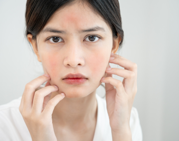 BÍ QUYẾT CHĂM SÓC DA NHẠY CẢM: HƯỚNG DẪN LỰA CHỌN SẢN PHẨM ĐẾN QUY TRÌNH SKINCARE TỐI GIẢN