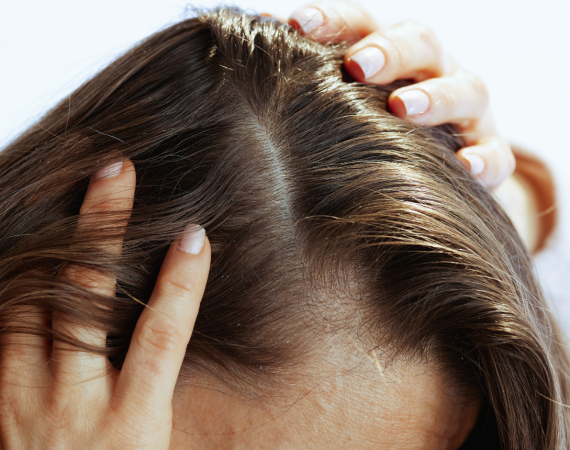 BẮT NHỊP THỊ TRƯỜNG CHĂM SÓC DA ĐẦU: GIẢI PHÁP GIA CÔNG TẨY TẾ BÀO CHẾT DA ĐẦU TRỌN GÓI