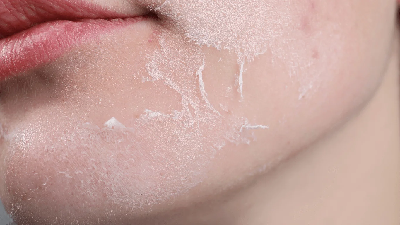 Skincare cho da khô chưa hiệu quả